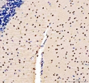 IHC staining of FFPE rat cerebellum tissue with LMNB1 antibody. HIER: boil tissue sections in pH8 EDTA for 20 min and allow to cool before testing.