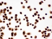 ICC testing of FFPE human SW480 cells with LMNB1 antibody. HIER: Boil the paraffin sections in pH 6, 10mM citrate buffer for 20 minutes and allow to cool prior to staining.