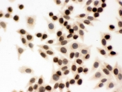ICC testing of FFPE human SMMC-7721 cells with LMNB1 antibody. HIER: Boil the paraffin sections in pH 6, 10mM citrate buffer for 20 minutes and allow to cool prior to staining.