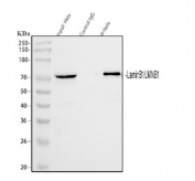 Immunoprecipitation of LMNB1 protein from 500ug of human HeLa whole cell lysate with 2ug of LMNB1 antibody.