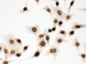 ICC testing of FFPE human A549 cells with LMNB1 antibody. HIER: Boil the paraffin sections in pH 6, 10mM citrate buffer for 20 minutes and allow to cool prior to staining.