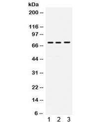 Western blot testing of human 1) 22RV1, 2) SW579 and 3) A549 cell lysate with Myelin-associated glycoprotein antibody. Observed molecular weight: 68~98 kDa depeding on level of glycosylation.
