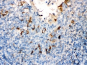 IHC testing of FFPE human tonsil with Filaggrin antibody. HIER: Boil the paraffin sections in pH 6, 10mM citrate buffer for 20 minutes and allow to cool prior to staining.