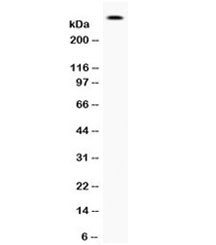 Western blot testing of human 22RV1 cell lysate with Filaggrin antibody. Predicted molecular weight ~434 kDa.~