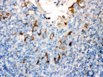 IHC testing of FFPE human tonsil with Filaggrin antibody. HIER: Boil the paraffin sections in pH 6, 10mM citrate buffer for 20 minutes a