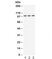 Western blot testing of human 1) HeLa, 2) MCF7 and 3) SMMC cell lysate with RASGAP antibody. Expected molecular weight ~116/100 kDa (long/short form).