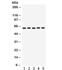 Western blot testing of 1) rat kidney, 2) mouse kidney, 3) human COLO320, 4) human HepG2 and 5) mouse HEPA lysate with MAOA antibody. Expected/observed molecular weight ~60 kDa.