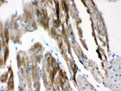 IHC testing of FFPE mouse heart with VDAC antibody. HIER: Boil the paraffin sections in pH 6, 10mM citrate buffer for 20 minutes and allow to cool prior to staining.