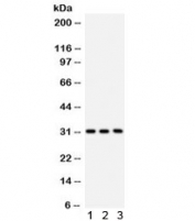 Western blot testing of 1) rat liver, 2) mouse liver and 3) human SMMC lysate with VDAC antibody. Expected/observed molecular weight ~31 kDa.