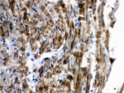 IHC testing of FFPE rat heart with VDAC antibody. HIER: Boil the paraffin sections in pH 6, 10mM citrate buffer for 20 minutes and allow to cool prior to staining.