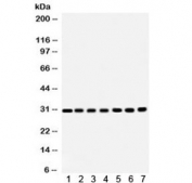 Western blot testing of 1) rat brain, 2) rat liver, 3) rat kidney, 4) mouse brain, 5) Jurkat, 6) CEM and 7) HeLa lysate with COMT antibody. Predicted molecular weight: ~30/25 kDa (isoforms 1/2).