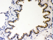 IHC testing of FFPE rat lung with COMT antibody. HIER: Boil the paraffin sections in pH 6, 10mM citrate buffer for 20 minutes and allow to cool prior to staining.