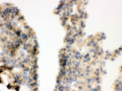 IHC testing of frozen mouse lung tissue with COMT antibody.
