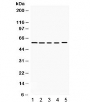 Western blot testing of 1) rat brain, 2) mouse brain, human 3) K562, 4) HeLa and 5) 22RV1 lysate with KCNA3 antibody. Expected molecular weight ~64 kDa, observed here at ~55 kDa.