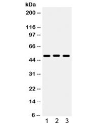 Western blot testing of 1) rat liver, 2) mouse liver, 3) human A549 lysate with BMP5 antibody. Expected/observed molecular weight ~51 kDa.