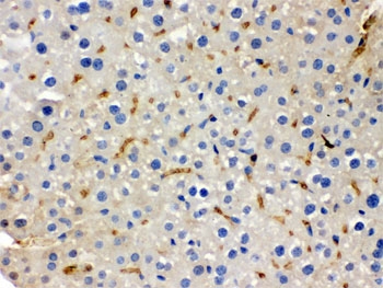 IHC testing of FFPE mouse liver with BMP5 antibody. HIER: Boil the paraffin sections in pH 6, 10mM citrate buffer for 20 minutes and allow to cool prior to staining.