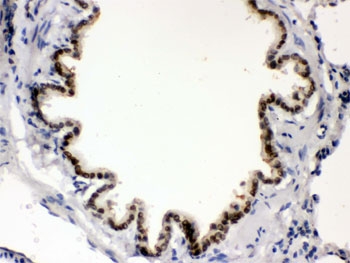 IHC testing of FFPE rat lung with BMP5 antibody. HIER: Boil the paraffin sections in pH 6, 10mM citrate buffer for 20 minutes and allow to cool prior to staining.