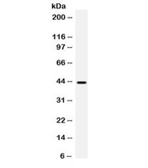Western blot testing of human HeLa cell lysate with BMP6 antibody. Expected molecular weight: ~57 kDa (precursor), ~46 kDa (cleaved precursor), 18-23 kDa (mature).~