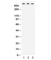 Western blot testing of human 1) MCF7, 2) SW620 and 3) HeLa cell lysate with TNXB antibody. Expected molecular weight ~458 kDa.