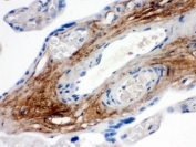 IHC testing of FFPE human placenta with TNXB antibody. HIER: Boil the paraffin sections in pH 6, 10mM citrate buffer for 20 minutes and allow to cool prior to staining.