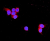 Immunofluorescent staining of FFPE human MCF7 cells with TNXB antibody (red) and DAPI nuclear stain (blue). HIER: steam section in pH6 citrate buffer for 20 min.