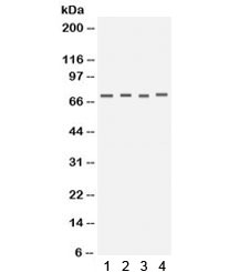Western blot testing of human 1) HeLa, 2) COLO320, 3) HT1080 and 4) PANC cell lysate with Kv1.4 antibody. Expected/observed molecular weight ~73 kDa.~