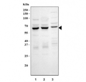 Western blot testing of 1) human HeLa, 2) human K562 and 3) rat RH35 cell lysate with CYP7A1 antibody. Expected molecular weight ~58 kDa.