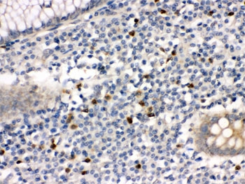 IHC testing of FFPE human appendicitis tissue with MMP-8 antibody. HIER: Boil the paraffin secti
