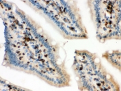 IHC testing of FFPE mouse intestine with Cofilin antibody. HIER: Boil the paraffin sections in pH 6, 10mM citrate buffer for 20 minutes and allow to cool prior to staining.