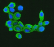 Immunofluorescent staining of FFPE human MCF7 cells with Cofilin antibody (green) and DAPI nuclear stain (blue). HIER: steam section in pH6 citrate buffer for 20 min.