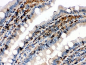IHC testing of FFPE rat intestine with Cofilin antibody. HIER: Boil the paraffin sections in pH 6, 10mM citrate buffer for 20 minutes and allow to cool prior to staining.