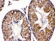 IHC testing of FFPE mouse testis with EDNRB antibody. HIER: Boil the paraffin sections in pH 6, 10mM citrate buffer for 20 minutes and allow to cool prior to staining.