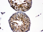 IHC testing of FFPE rat testis with EDNRB antibody. HIER: Boil the paraffin sections in pH 6, 10mM citrate buffer for 20 minutes and allow to cool prior to staining.