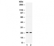 Western blot testing of human 1) U20S and 2) HeLa lysate with IGFBP5 antibody. Expected molecular weight: 30 kDa (intact protein), 19-24 kDa (cleavage fragments), 22 kDa (major fragment).