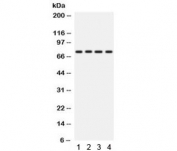 Western blot testing of human 1) A431, 2) A549, 3) HeLa and 4) SKOV lysate with PKC eta antibody. Predicted/observed molecular weight ~78 kDa.