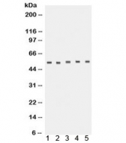 Western blot testing of 1) human placenta, 2) rat lung, 3) rat brain, 4) U87 and 5) A431 lysate with TACR1 antibody. Predicted molecular weight ~46 kDa but routinely observed at ~58 kDa.