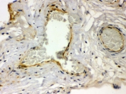 IHC testing of FFPE human placenta with Thrombin Receptor antibody. HIER: Boil the paraffin sections in pH 6, 10mM citrate buffer for 20 minutes and allow to cool prior to staining.