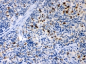 IHC testing of FFPE rat spleen with TNFRSF1B antibody. HIER: Boil the paraffin sections in pH 6, 10mM citrate buffer for 20 minutes and allow to cool prior to staining.