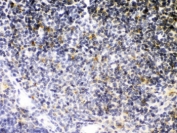 IHC testing of FFPE mouse thymus with TNFRSF1B antibody. HIER: Boil the paraffin sections in pH 6, 10mM citrate buffer for 20 minutes and allow to cool prior to staining.