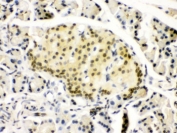 IHC testing of FFPE rat pancreas with PAX6 antibody. HIER: Boil the paraffin sections in pH 6, 10mM citrate buffer for 20 minutes and allow to cool prior to staining.