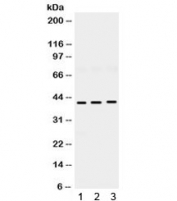 Western blot testing of 1) rat brain, 2) mouse brain and 3) human U87 lysate with HuD antibody. Expected/observed molecular weight ~42 kDa.