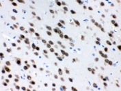 IHC testing of FFPE rat brain with HuD antibody. HIER: Boil the paraffin sections in pH 6, 10mM citrate buffer for 20 minutes and allow to cool prior to staining.