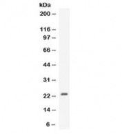 Western blot testing of human MCF7 cell lysate with CNTF antibody. Expected/observed molecular weight ~23 kDa.