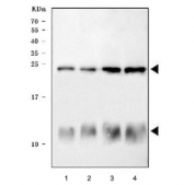 Western blot testing of 1) mouse heart, 2) rat heart, 3) human COLO320 and 4) human K562 lysate with PLN antibody. Predicted molecular weight: 6/18/24/36 kDa (monomer/oligomers).