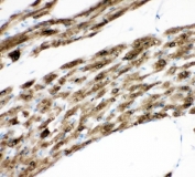 IHC staining of FFPE rat heart tissue with PLN antibody. HIER: boil tissue sections in pH8 EDTA for 20 min and allow to cool before testing.