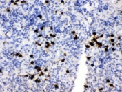 IHC testing of FFPE rat spleen with S100A8 antibody. HIER: Boil the paraffin sections in pH 6, 10mM citrate buffer for 20 minutes and allow to cool prior to staining.