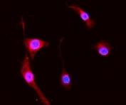 Immunofluorescent staining of FFPE mouse NIH 3T3 cells with S100A8 antibody (red) and DAPI nuclear stain (blue). HIER: steam section in pH6 citrate buffer for 20 min.
