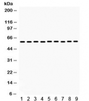 Western blot testing of 1) rat heart, 2) rat kidney, 3) rat intestine, 4) mouse kidney, 5) mouse intestine, 6) mouse heart, 7) Human HepG2, 8) human HeLa and 9) human COLO320 lysate with MAOB antibody. Expected/observed molecular weight ~59 kDa.