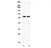 Western blot testing of 1) rat brain and 2) mouse brain lysate with MAOB antibody. Expected/observed molecular weight ~59 kDa.