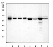 Western blot testing of 1) human SiHa, 2) human HepG2, 3) human HeLa, 4) human placenta, 5) rat liver, 6) rat brain, 7) mouse liver and 8) mouse brain tissue lysate with MAOB antibody. Predicted weight ~59 kDa.